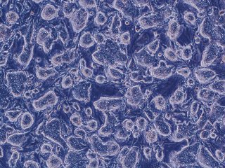 Celulas iPS