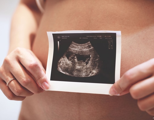 Abortos en España. Según el Ministerio de Sanidad, desciende su número, posiblemente por cambios sociodemográficos, y por disminución de embarazos y partos.