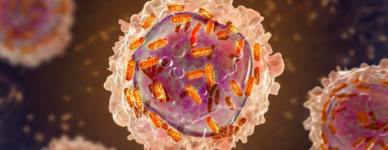 Esperanza contra el cáncer: una nueva inmunoterapia logra remisiones en tumores sólidos hereditarios
